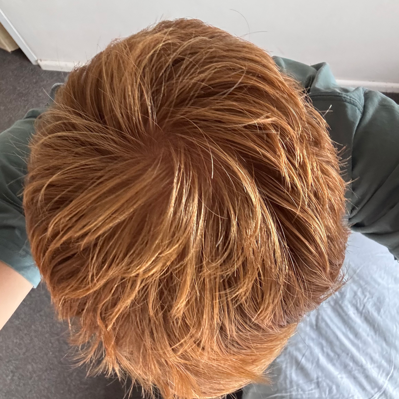 Upload a photo of the crown of your head, similar to the example image provided