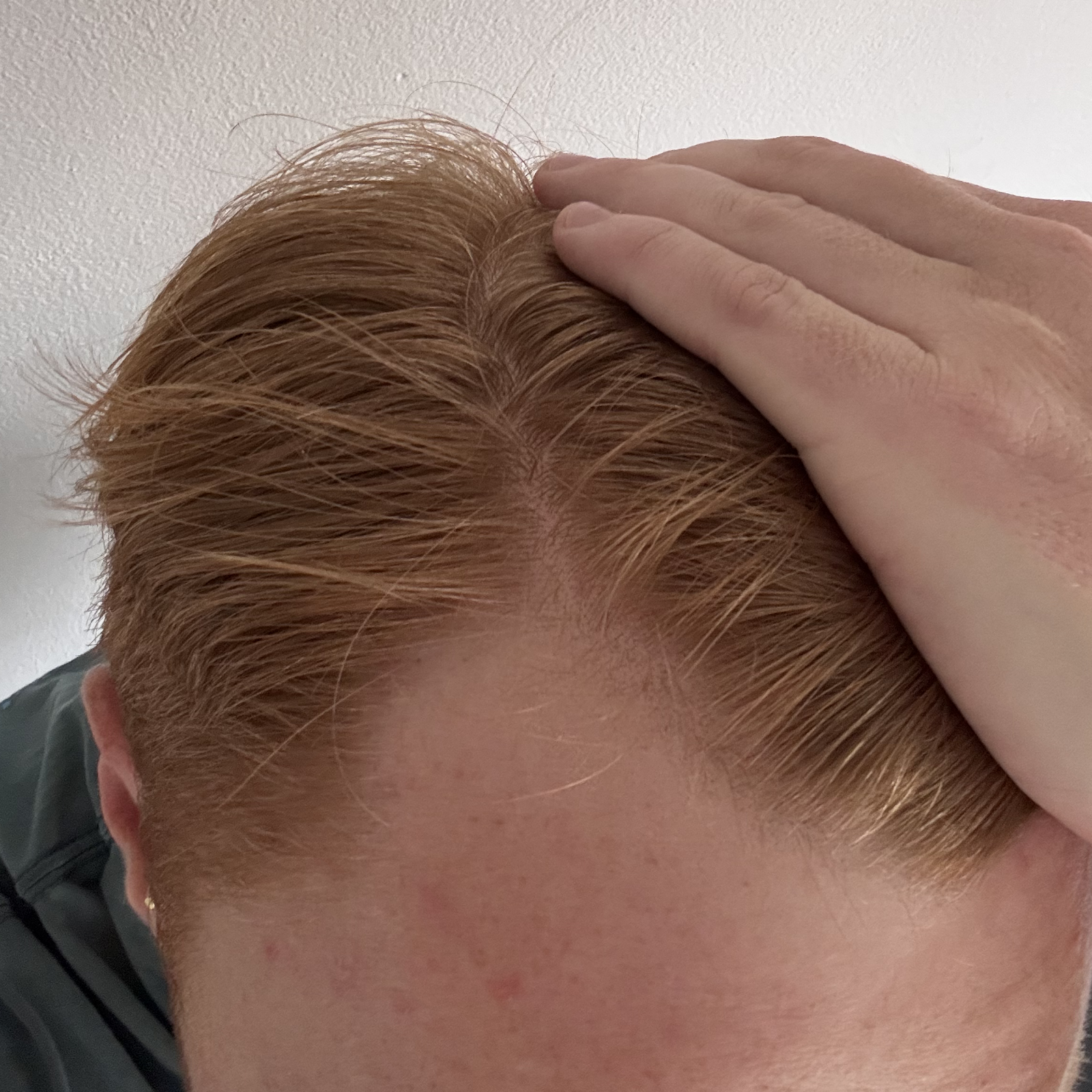 Upload a photo of your parted hair, similar to the example image provided